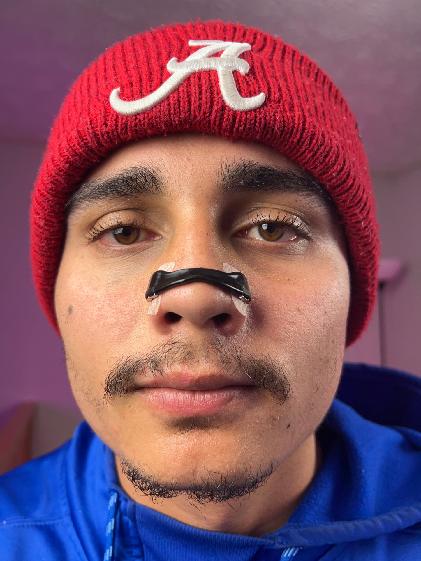 Snorex Magnetic Nasal Strips