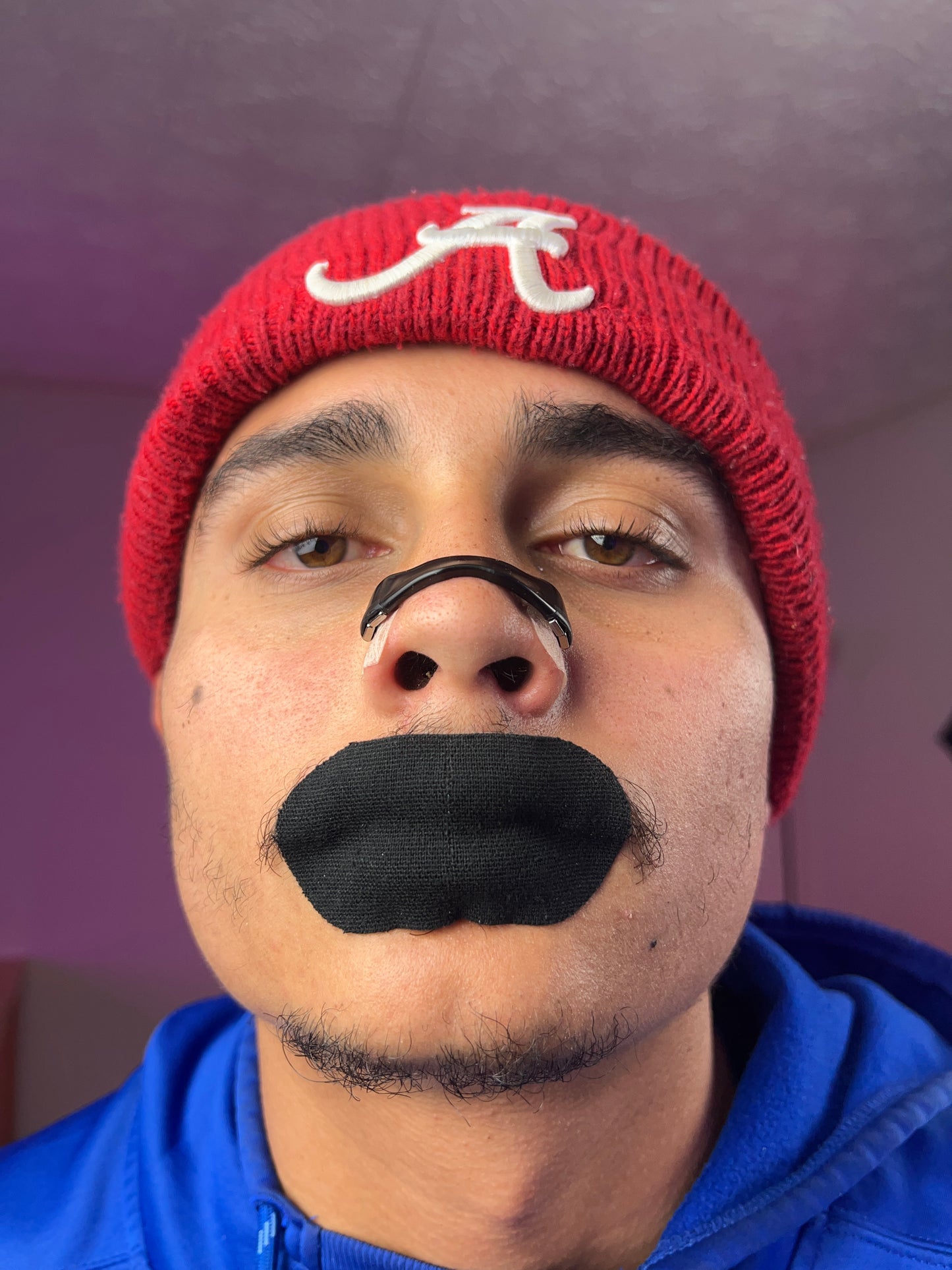 Snorex Magnetic Nasal Strips