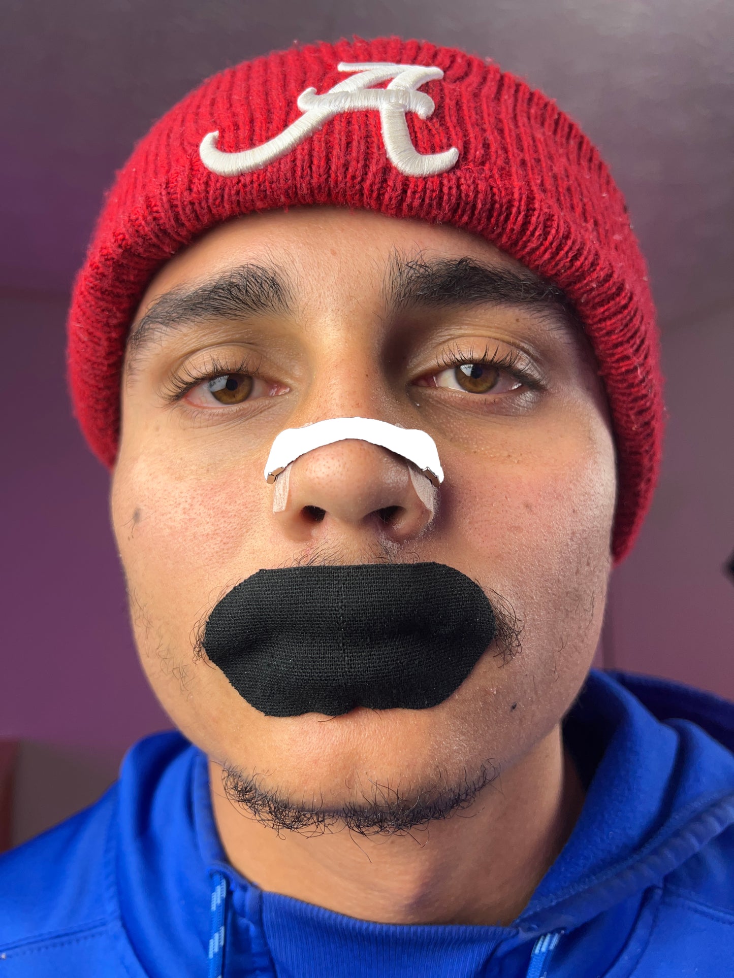Snorex Magnetic Nasal Strips