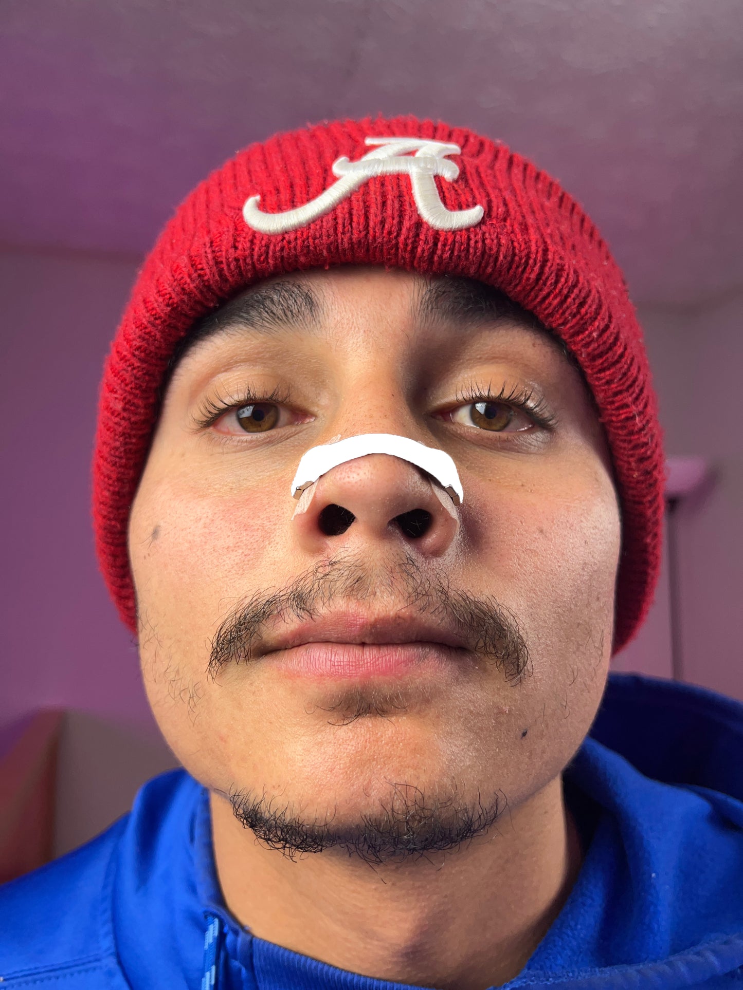 Snorex Magnetic Nasal Strips